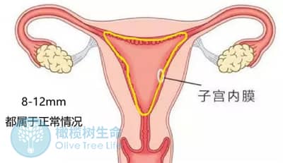 子宫内膜厚度多少适合？移植前内膜不达标如何应对