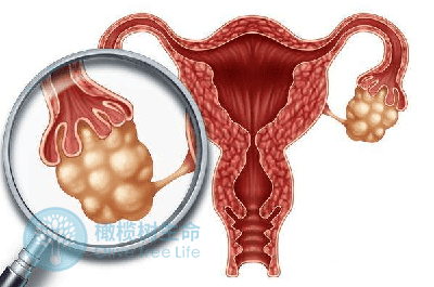 泰国试管婴儿:如何杜绝促排卵对女性造成的伤害?