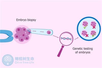 移植后特别焦虑紧张怎么办？橄榄树生命教您三招缓解