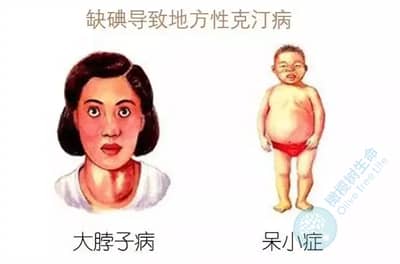 试管备孕饮食注意事项：备孕期、孕期注意科学补碘