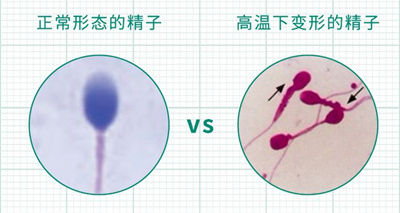 细数肥胖7宗罪，这些影响50%的备孕姐妹都不知道！