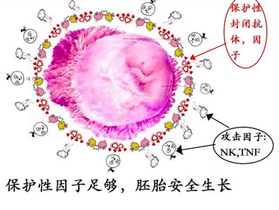 导致复发性流产的罕见因素，九成备孕姐妹都想不到！