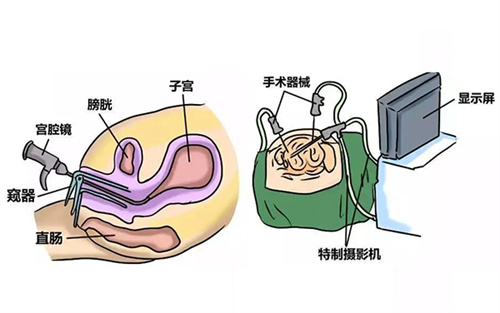 AMH数值太低？做好这4点也能逆风翻盘！