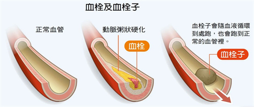 什么？“神药”阿司匹林又又又有新作用了？