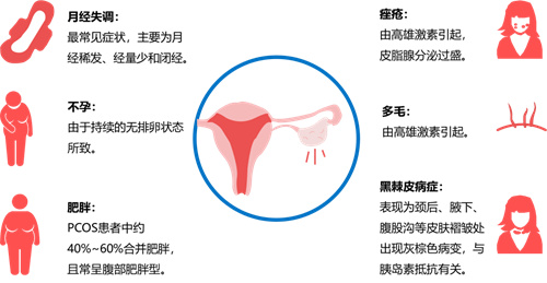 中国每10位女性就有1位多囊，多囊卵巢不只是影响生育